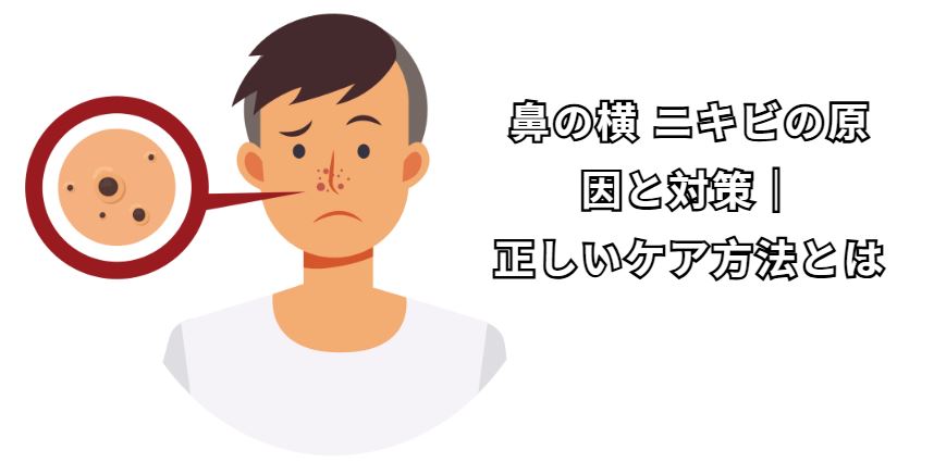 鼻 の横 ニキビ