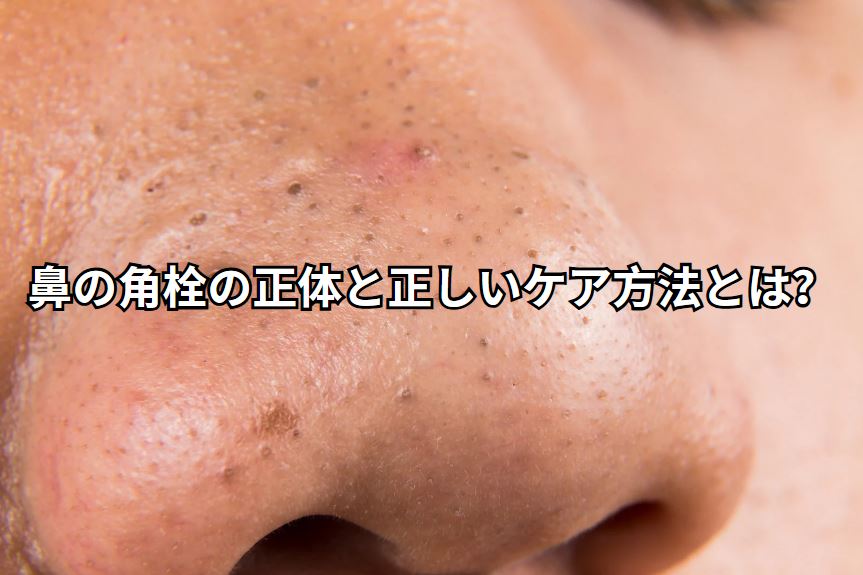 鼻 角栓