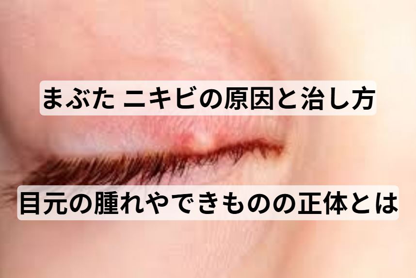まぶた ニキビ