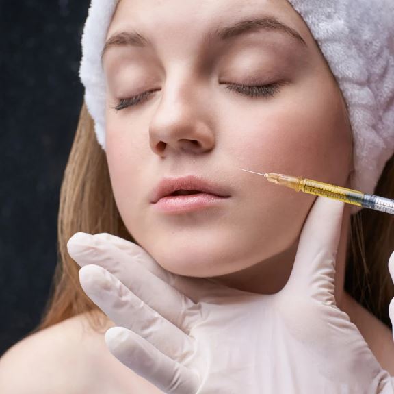 ほうれい線 ボトックス