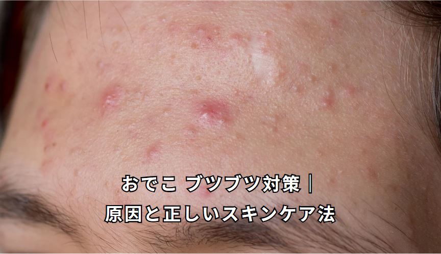 おでこ ブツブツ